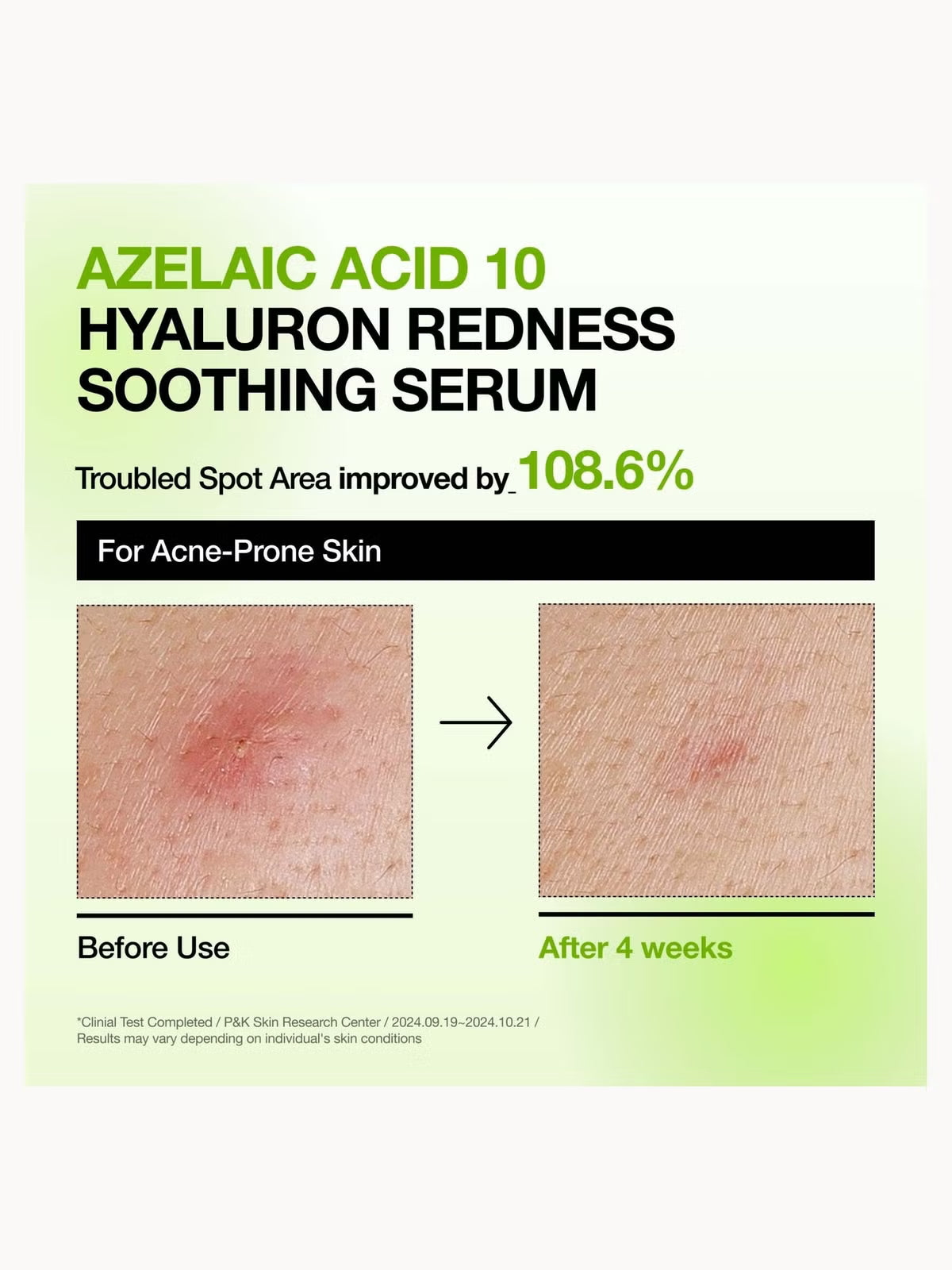 Anua KPop Demon Hunters Calming Skin Discovery Set