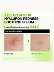 Anua KPop Demon Hunters Calming Skin Discovery Set