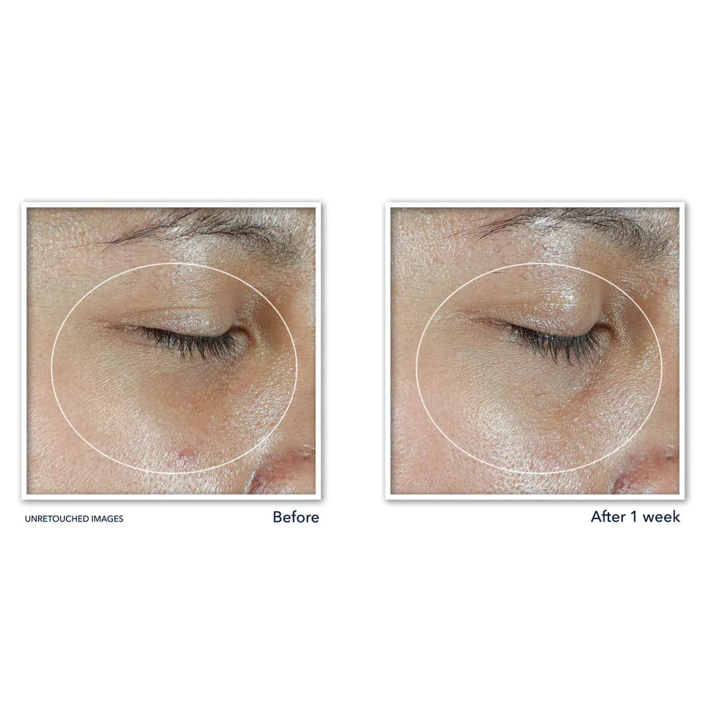 RoC Multi Correxion Revive + Glow Vitamin C Eye Balm