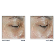 RoC Multi Correxion Revive + Glow Vitamin C Eye Balm