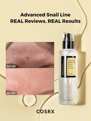 Advanced Snail 96 Mucin Power Essence (100ml)