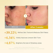 medicube - Kojic Acid Turmeric Resurfacing Toner
